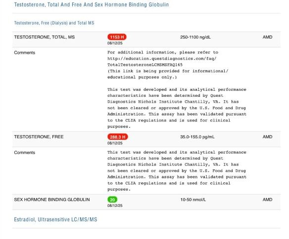 Quest Diagnostics panel: Testosterone Total 1153 ng/dL (ref 250-1100), Free T 288.3 pg/mL (ref 35-155), SHBG 20 nmol/L